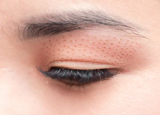 Dermatologie esthétique à Grenoble